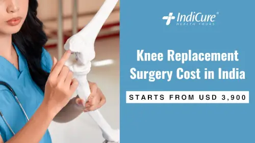 Knee Replacement Surgery Cost in India